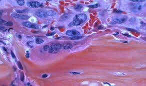 Image Source : Public Domain