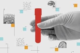 Image Source : Public Domain