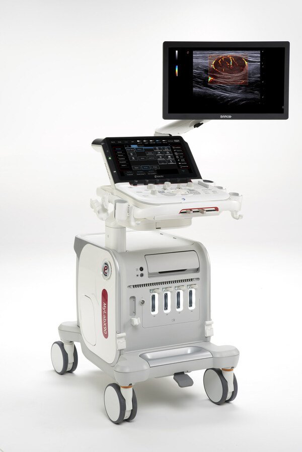 MyLab™X90,Esaote new premium ultrasound system.
