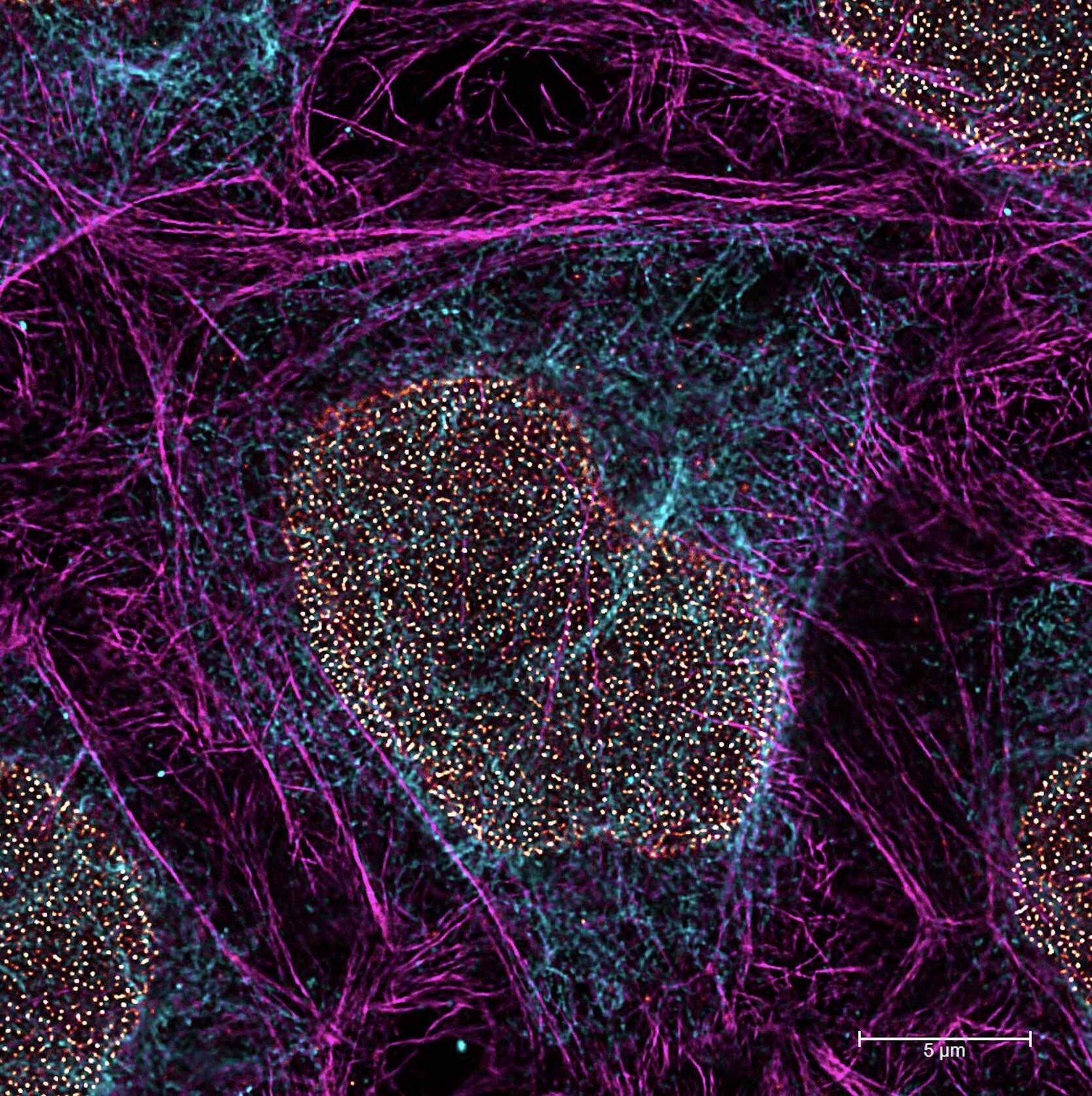 STED for Cell Biology: Multicolor fixed-sample. Image acquired using TauSTED Xtend 775; Vimentin AF 594 (cyan), Phalloidin Multicolor fixed-sample TauSTED Xtend 775; Vimentin AF 594 (cyan), Phalloidin ATTO 647N (magenta) and NUP107 CF680R (glow). Triple color STED imaging with a single depletion line at low STED power. ATTO 647N (magenta) and NUP107 CF680R (glow). Triple color STED imaging with a single depletion line at low STED power. Scale bar: 5 µm. Sample courtesy of Brigitte Bergner, Mariano Gonzales Pisfil, Steffen Dietzel, Core Facility Bioimaging, Biomedical Center, Ludwig-Maximilians-University, Munich, Germany.
