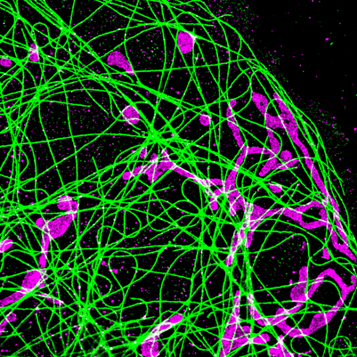 Two-color (d)STORM imaging of a fixed COS-7 cell: microtubules were immunolabeled with CF®647 conjugate, and mitochondria were immunolabeled with CF®583R conjugate. Image courtesy of Bowen Wang, Michael Xiong, and Professor Ke Xu, College of Chemistry, University of California, Berkeley.